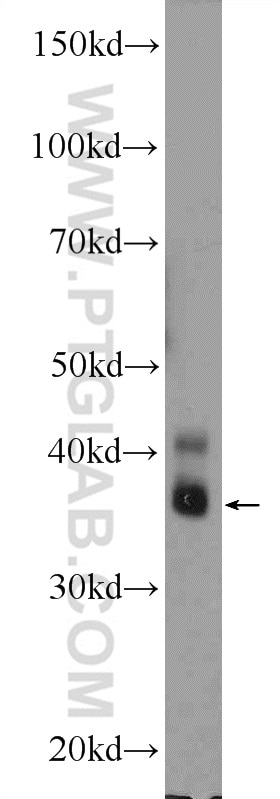 WB analysis of U-937 using 14271-1-AP