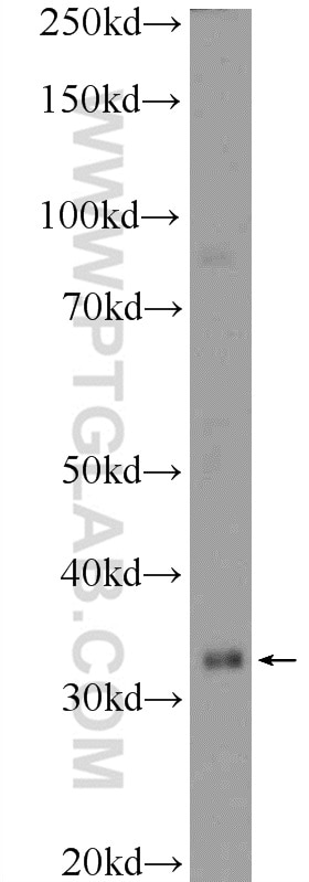 Western Blot (WB) analysis of mouse liver tissue using CEBPE Polyclonal antibody (14271-1-AP)