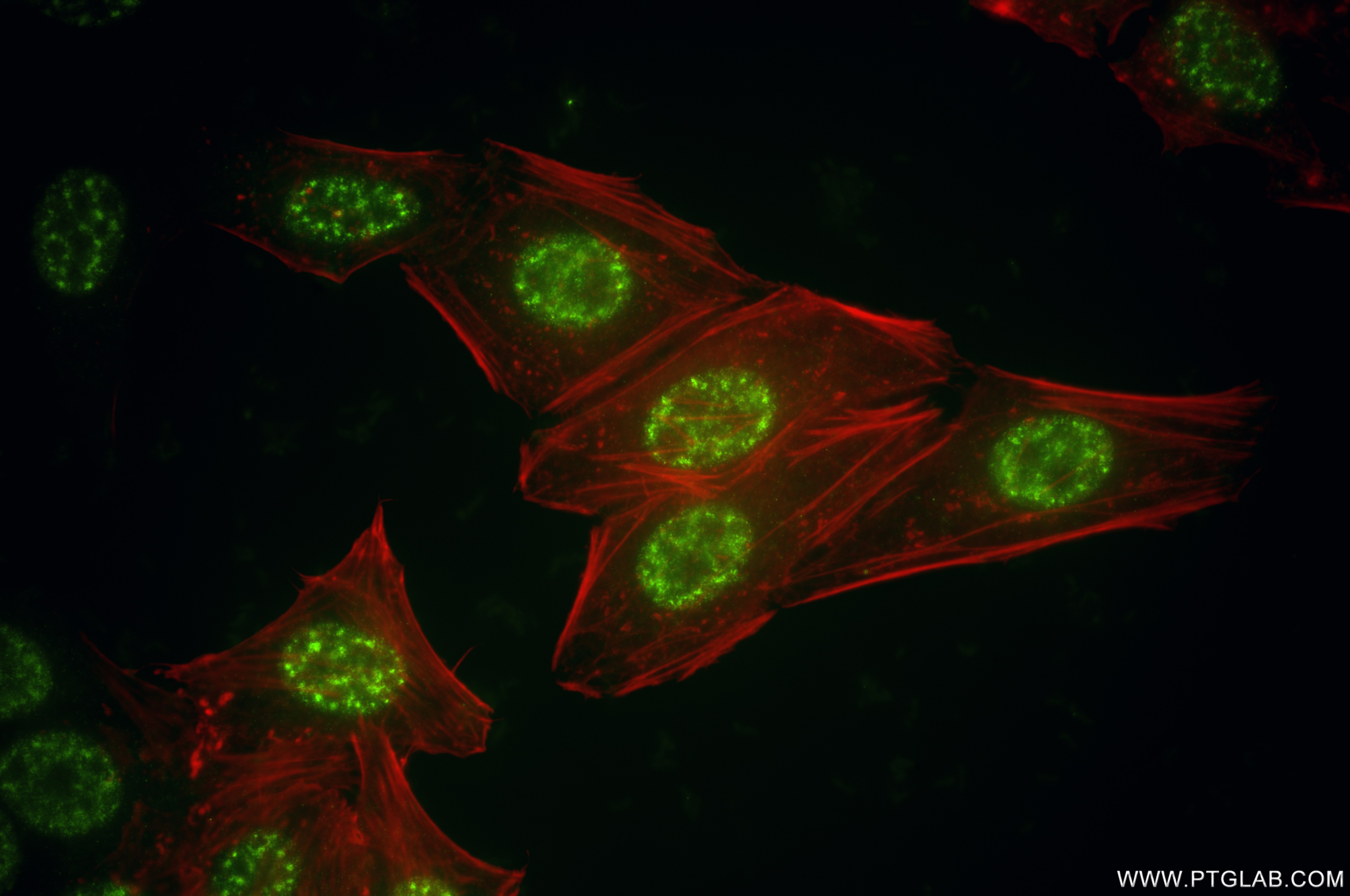 Immunofluorescence (IF) / fluorescent staining of HepG2 cells using CEBPE Recombinant antibody (86432-1-RR)