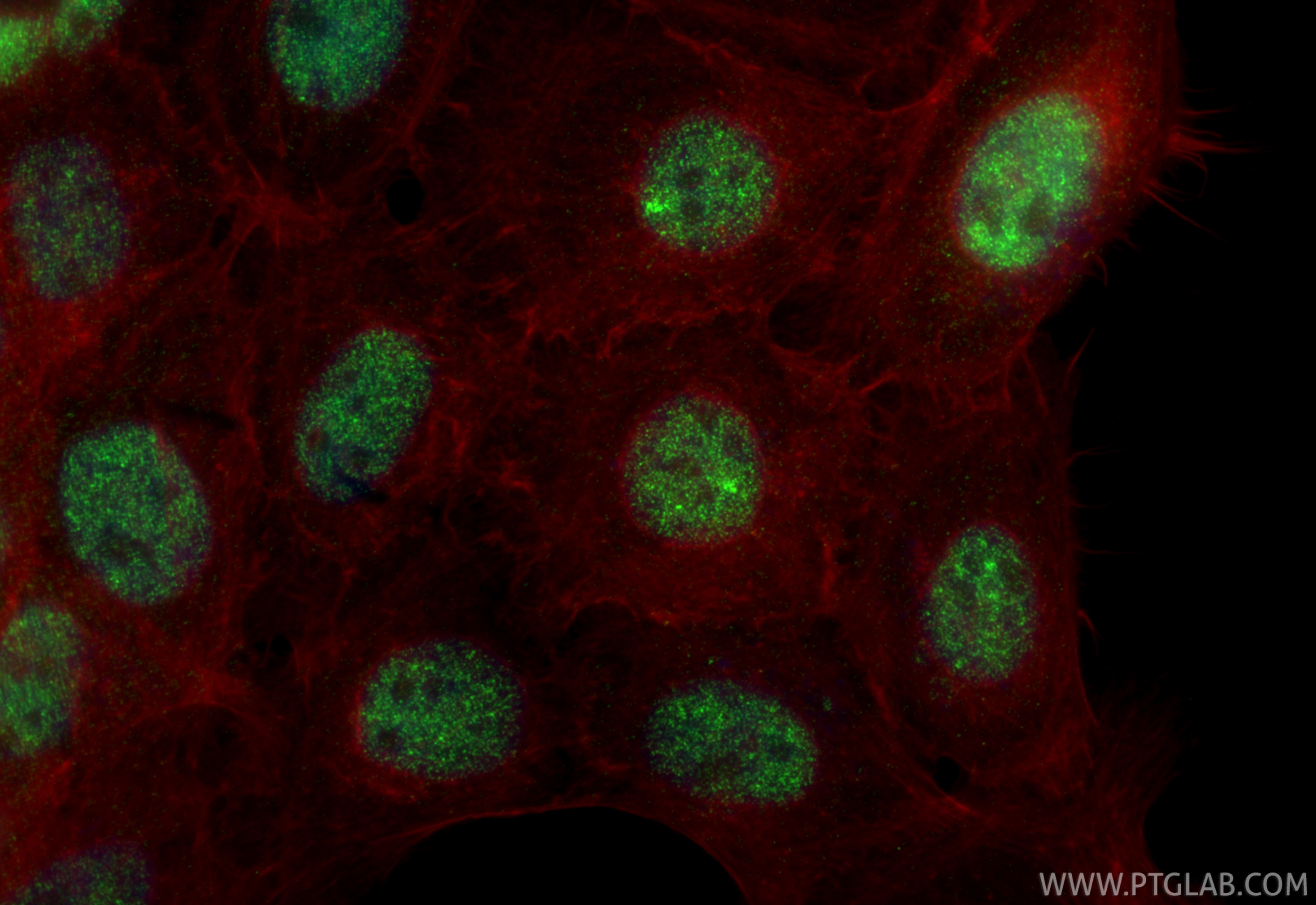Immunofluorescence (IF) / fluorescent staining of A431 cells using CEBPE Recombinant monoclonal antibody (86432-1-RR)