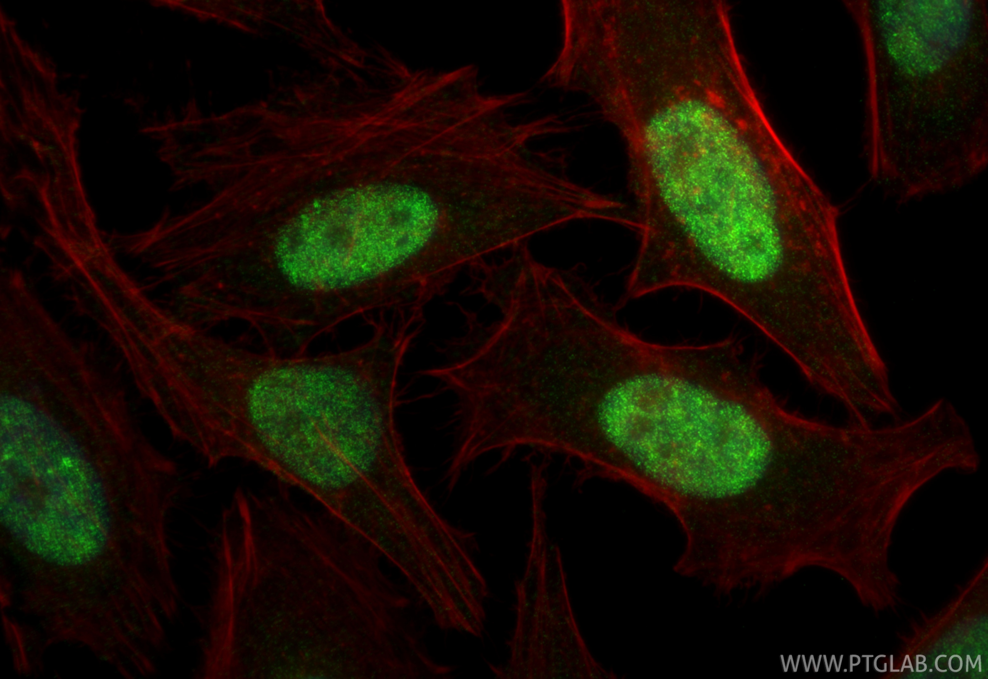 Immunofluorescence (IF) / fluorescent staining of HeLa cells using CEBPE Recombinant monoclonal antibody (86432-1-RR)
