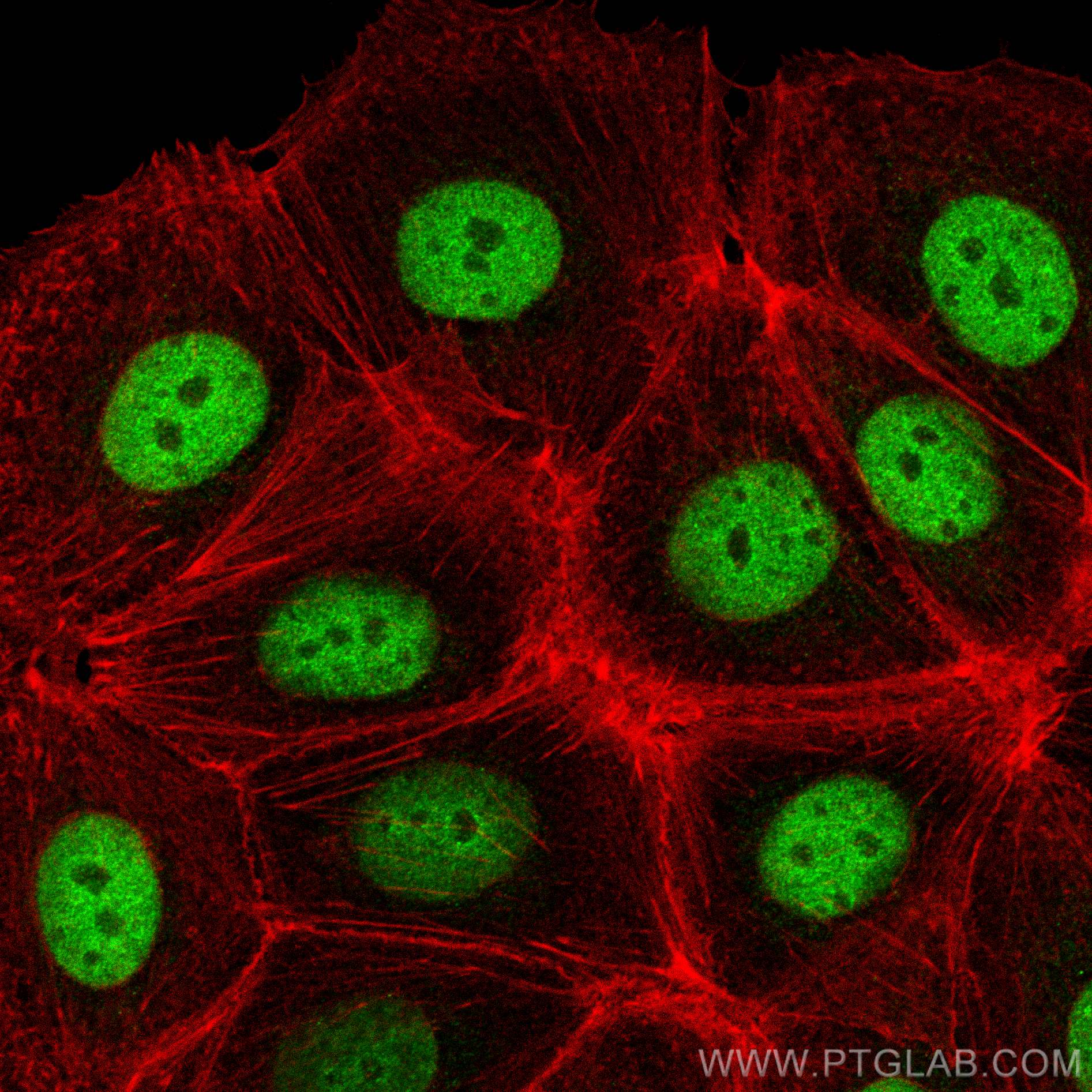 IF Staining of MCF-7 using 12997-1-AP