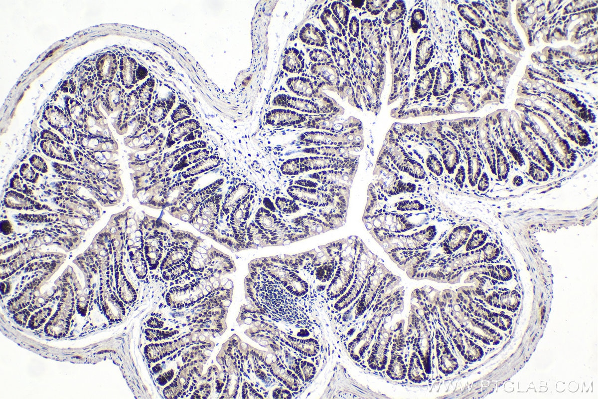 Immunohistochemistry (IHC) staining of mouse colon tissue using CEBPG Polyclonal antibody (12997-1-AP)