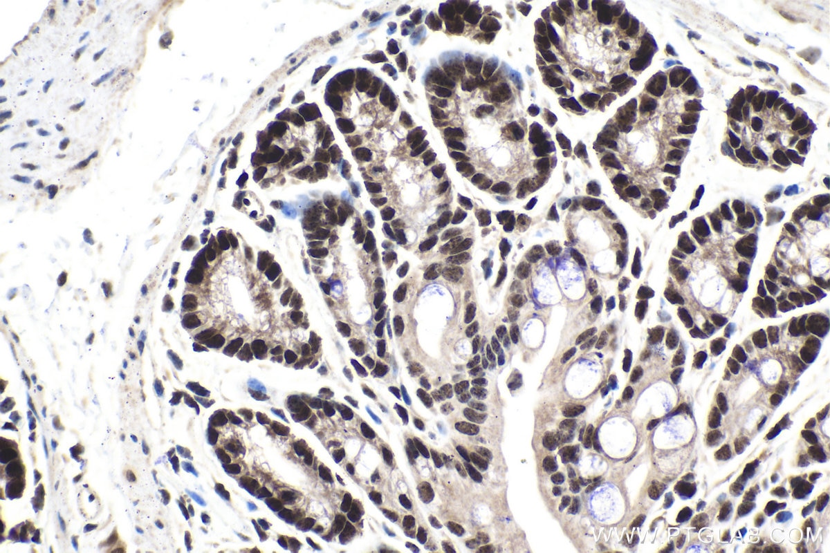 Immunohistochemistry (IHC) staining of mouse colon tissue using CEBPG Polyclonal antibody (12997-1-AP)