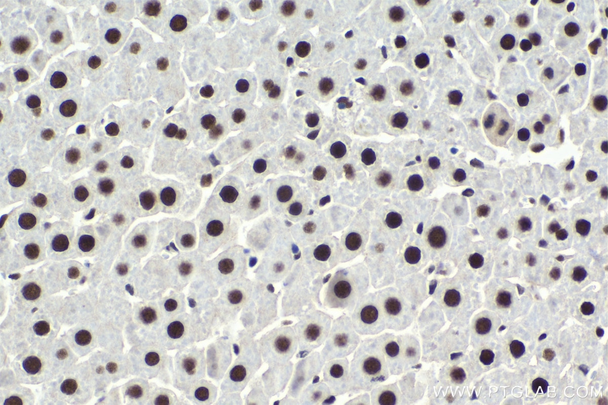 Immunohistochemistry (IHC) staining of rat liver tissue using CEBPG Polyclonal antibody (12997-1-AP)