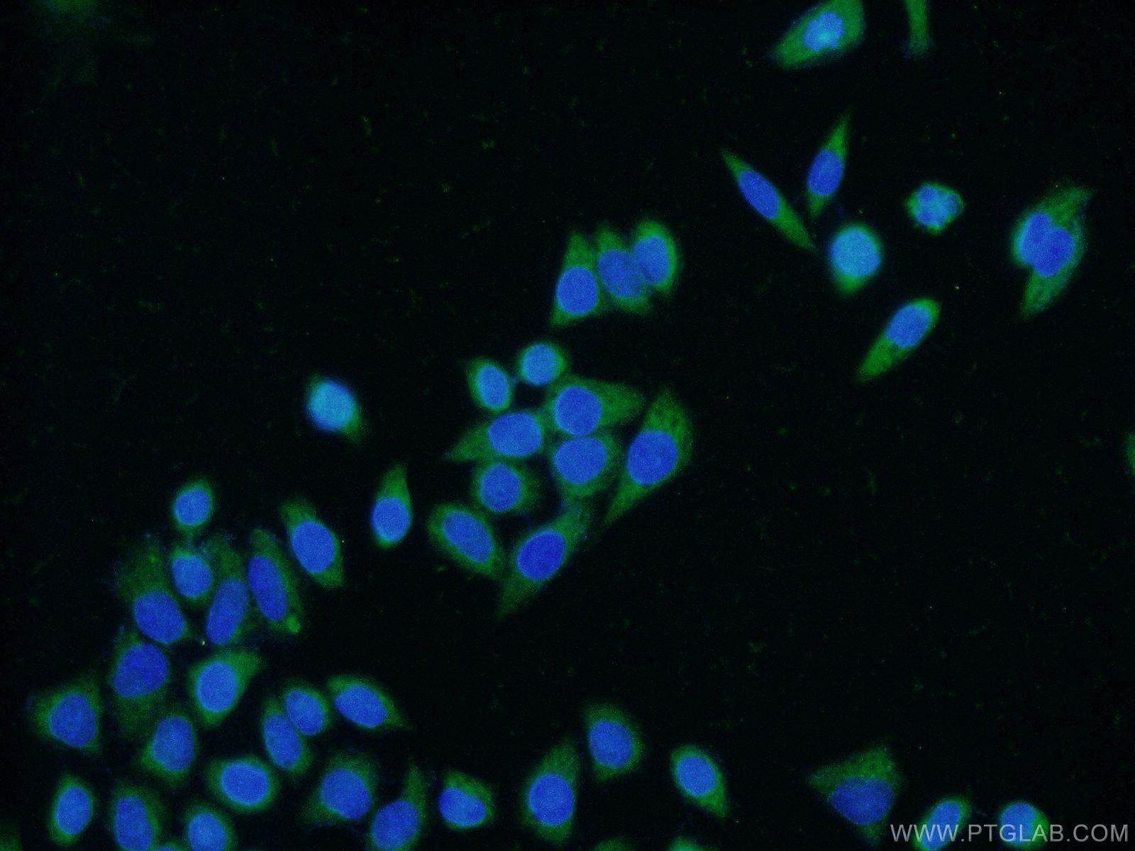 Immunofluorescence (IF) / fluorescent staining of HeLa cells using CEBPZ Polyclonal antibody (25612-1-AP)