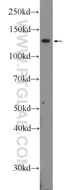 WB analysis of mouse testis using 25612-1-AP