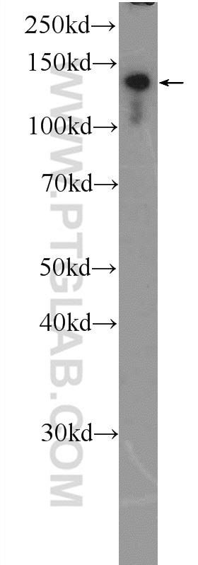 WB analysis of HeLa using 25612-1-AP