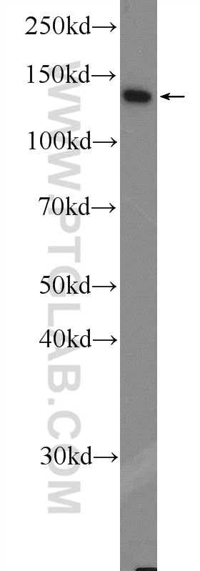 Western Blot (WB) analysis of mouse testis tissue using CEBPZ Polyclonal antibody (25612-1-AP)