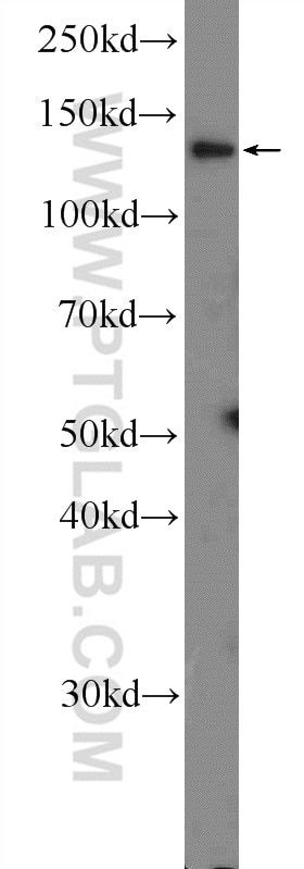 Western Blot (WB) analysis of mouse testis tissue using CEBPZ Polyclonal antibody (25612-1-AP)