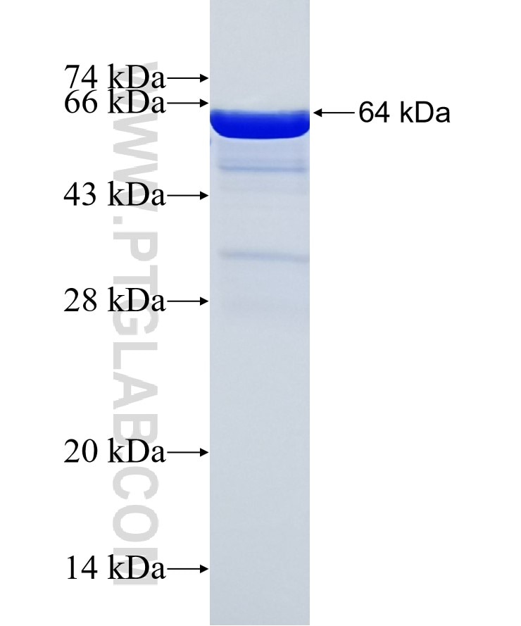 CECR1 fusion protein Ag5431 SDS-PAGE