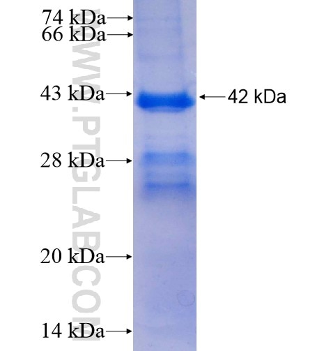 CECR1 fusion protein Ag6168 SDS-PAGE