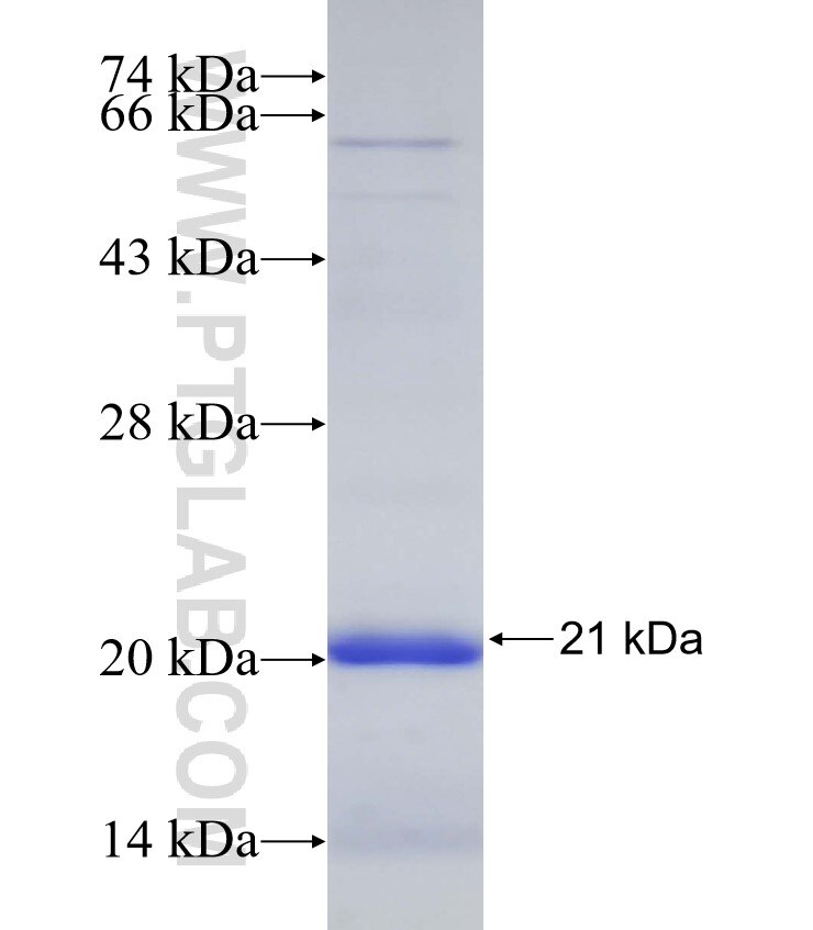 CECR2 fusion protein Ag32908 SDS-PAGE CECR2 fusion protein Ag32908 SDS-PAGE