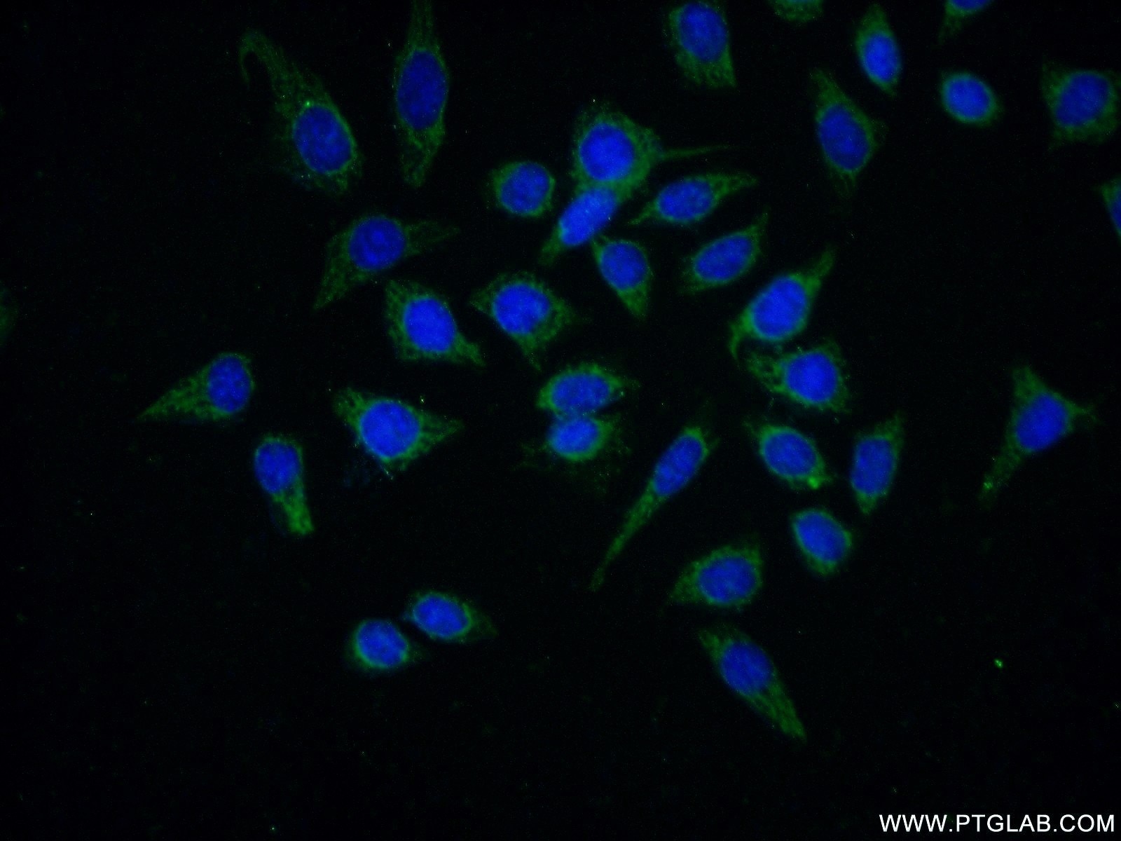 Immunofluorescence (IF) / fluorescent staining of HeLa cells using CEL Polyclonal antibody (15384-1-AP)