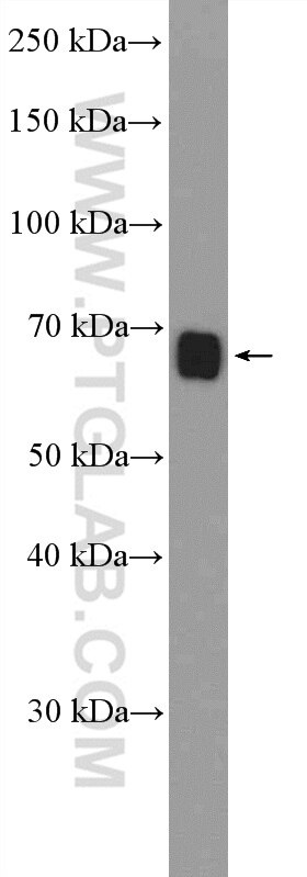Western Blot (WB) analysis of mouse heart tissue using CEL Polyclonal antibody (15384-1-AP)