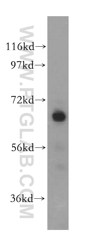 Western Blot (WB) analysis of HeLa cells using CEL Polyclonal antibody (15384-1-AP)