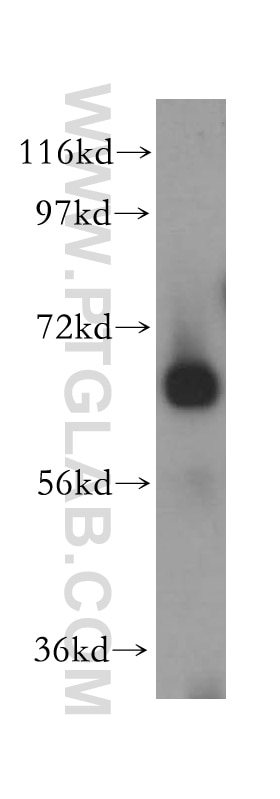 Western Blot (WB) analysis of human liver tissue using CEL Polyclonal antibody (15384-1-AP)