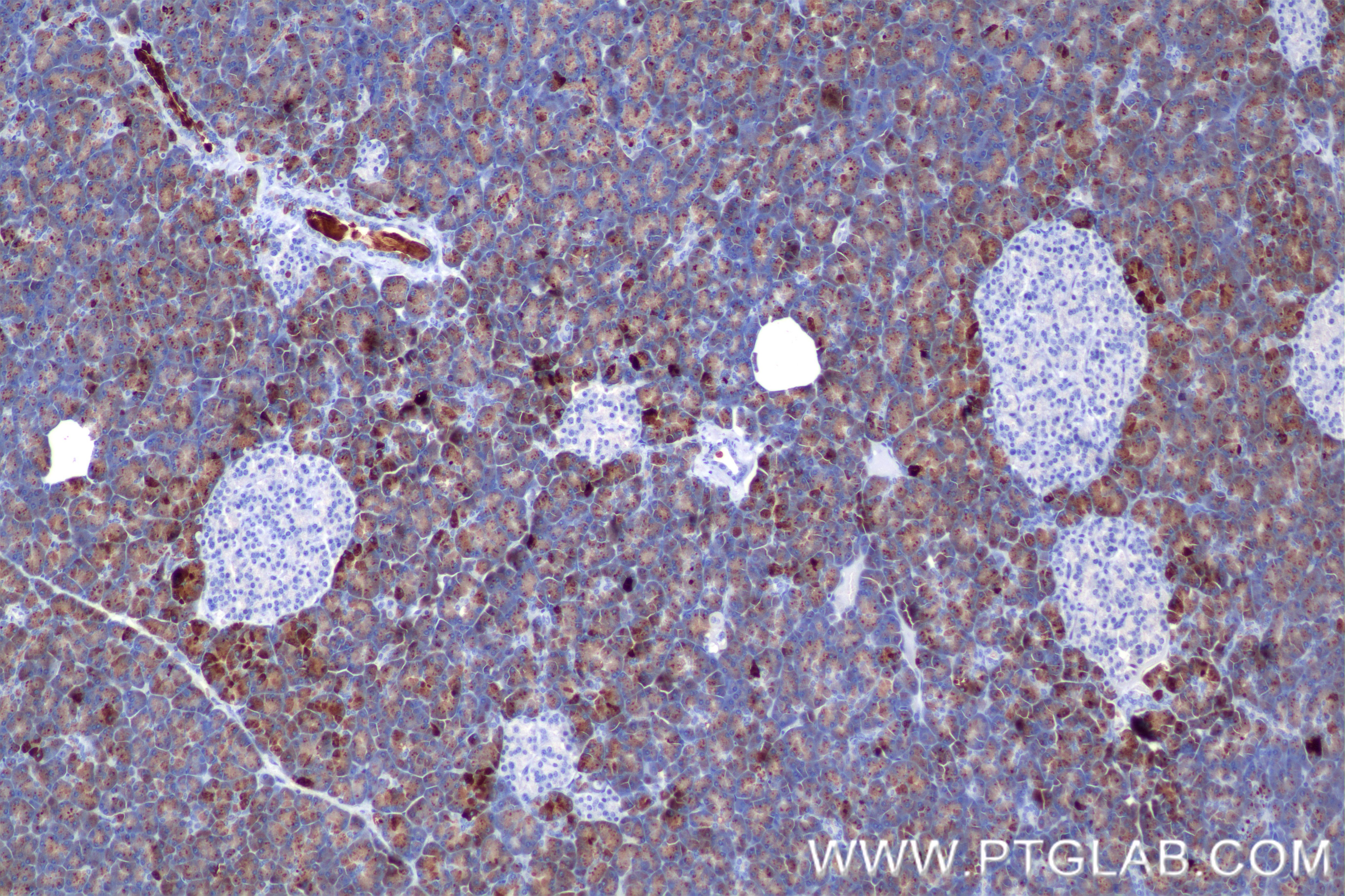Immunohistochemistry (IHC) staining of human pancreas tissue using CEL Recombinant monoclonal antibody (85081-4-RR)