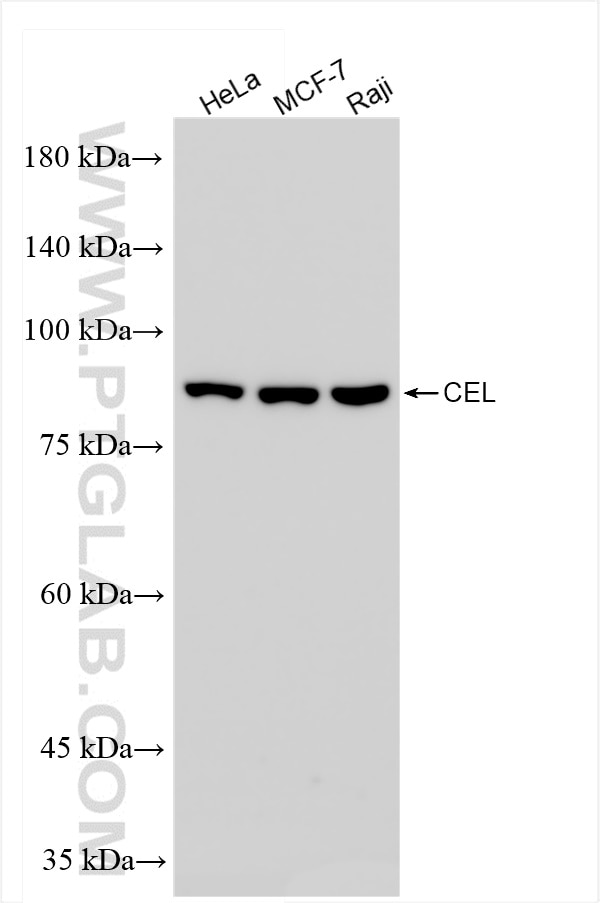 Western Blot (WB) analysis of various lysates using CEL Recombinant antibody (85081-4-RR)