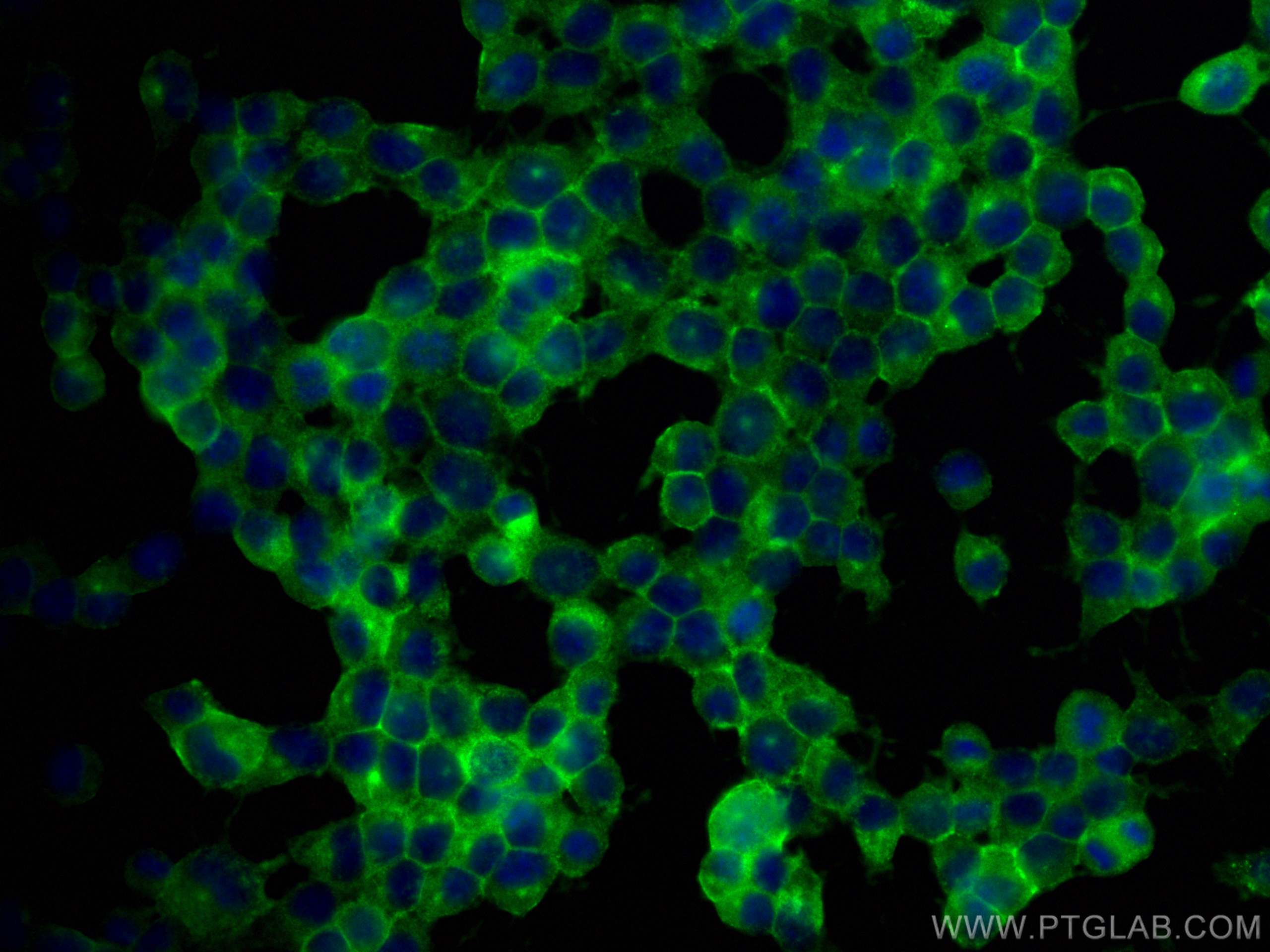 Immunofluorescence (IF) / fluorescent staining of Neuro-2a cells using CEND1 Polyclonal antibody (13280-1-AP)