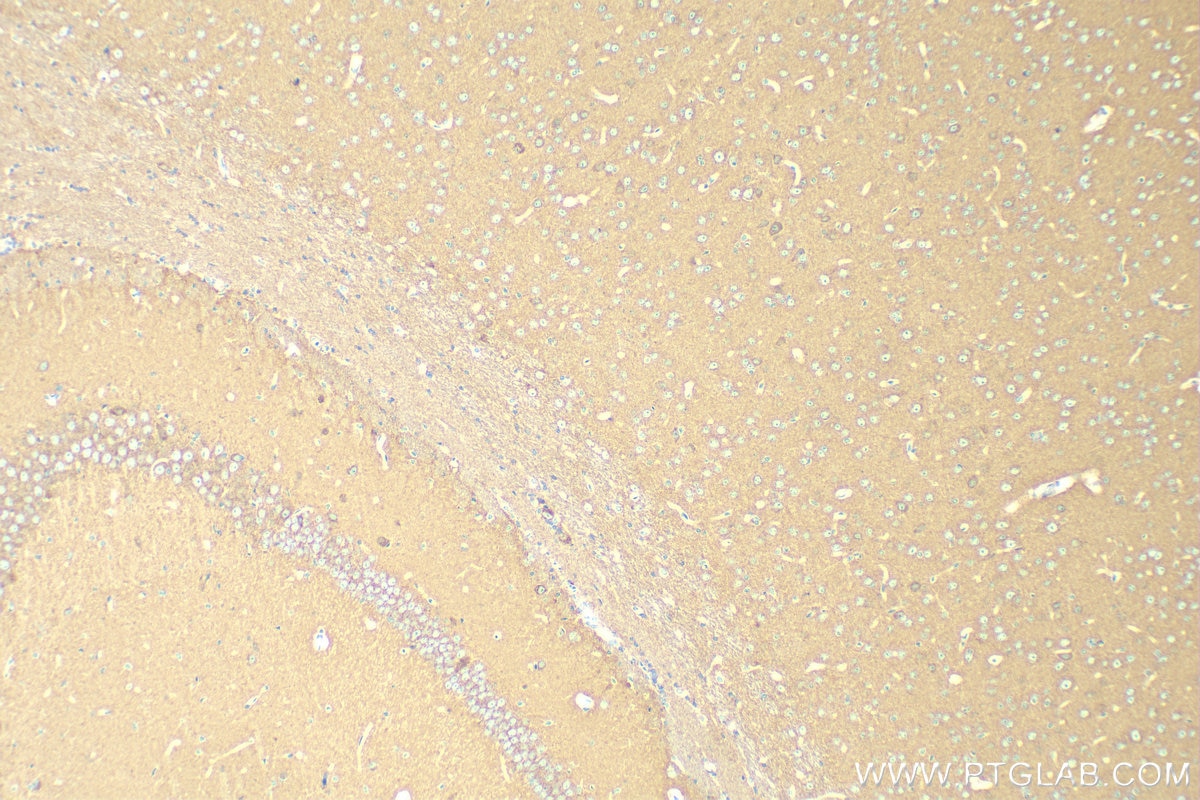 Immunohistochemistry (IHC) staining of mouse brain tissue using CEND1 Polyclonal antibody (13280-1-AP)