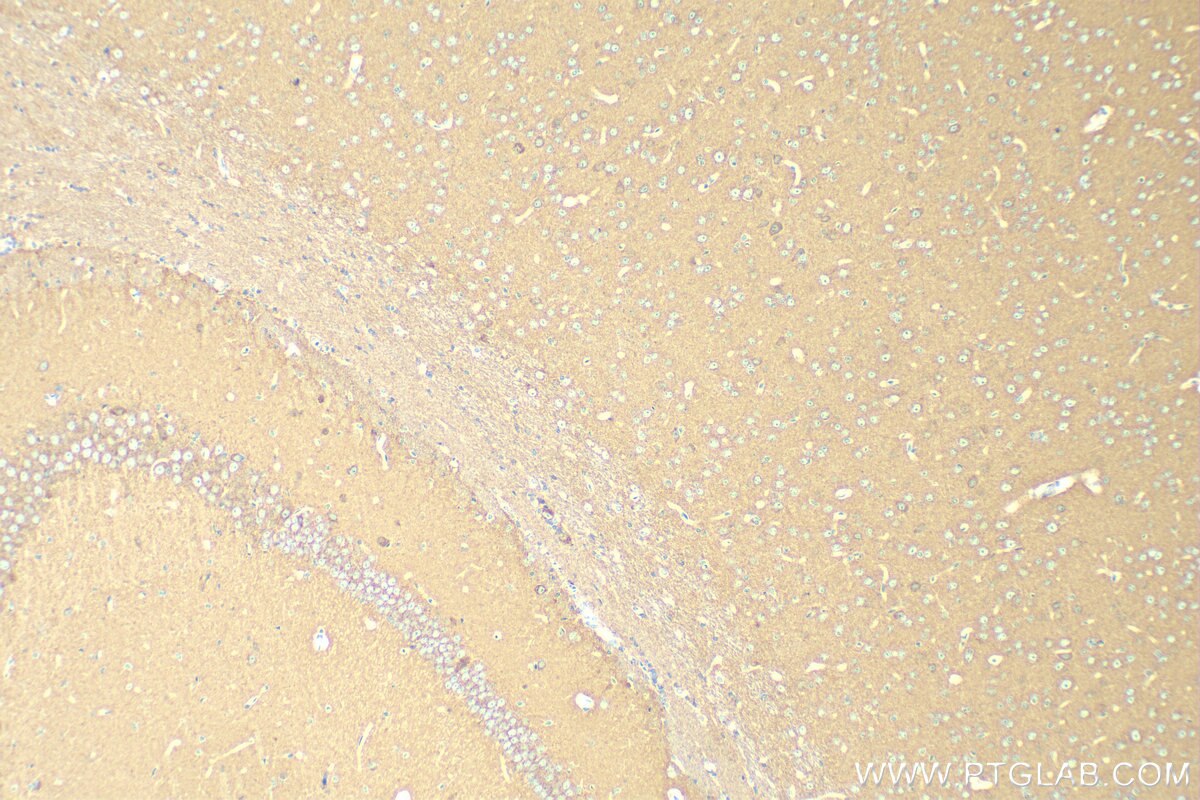 Immunohistochemistry (IHC) staining of mouse brain tissue using CEND1 Polyclonal antibody (13280-1-AP)