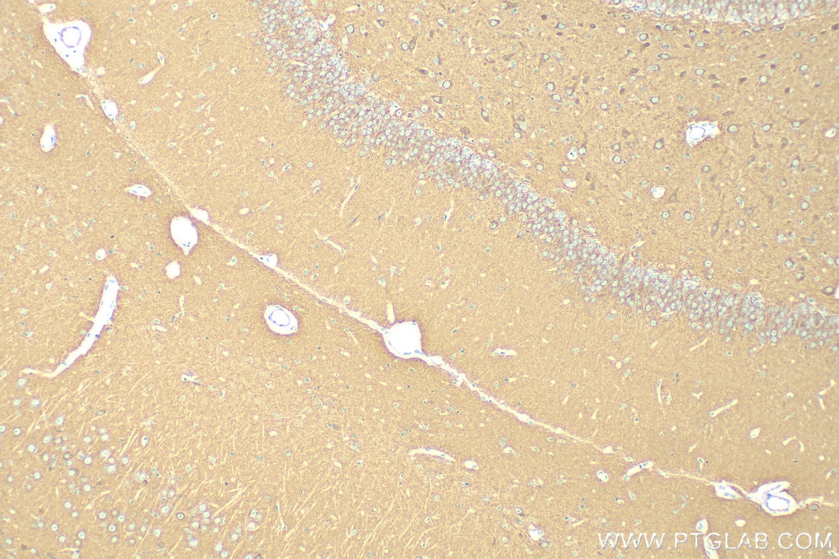 Immunohistochemistry (IHC) staining of rat brain tissue using CEND1 Polyclonal antibody (13280-1-AP)