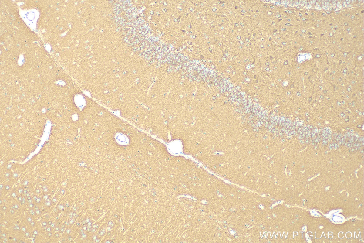 IHC staining of rat brain using 13280-1-AP