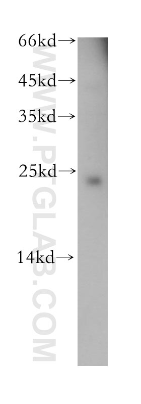 Western Blot (WB) analysis of human brain tissue using CEND1 Polyclonal antibody (13280-1-AP)