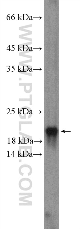 Western Blot (WB) analysis of Jurkat cells using CENPA Polyclonal antibody (26754-1-AP)