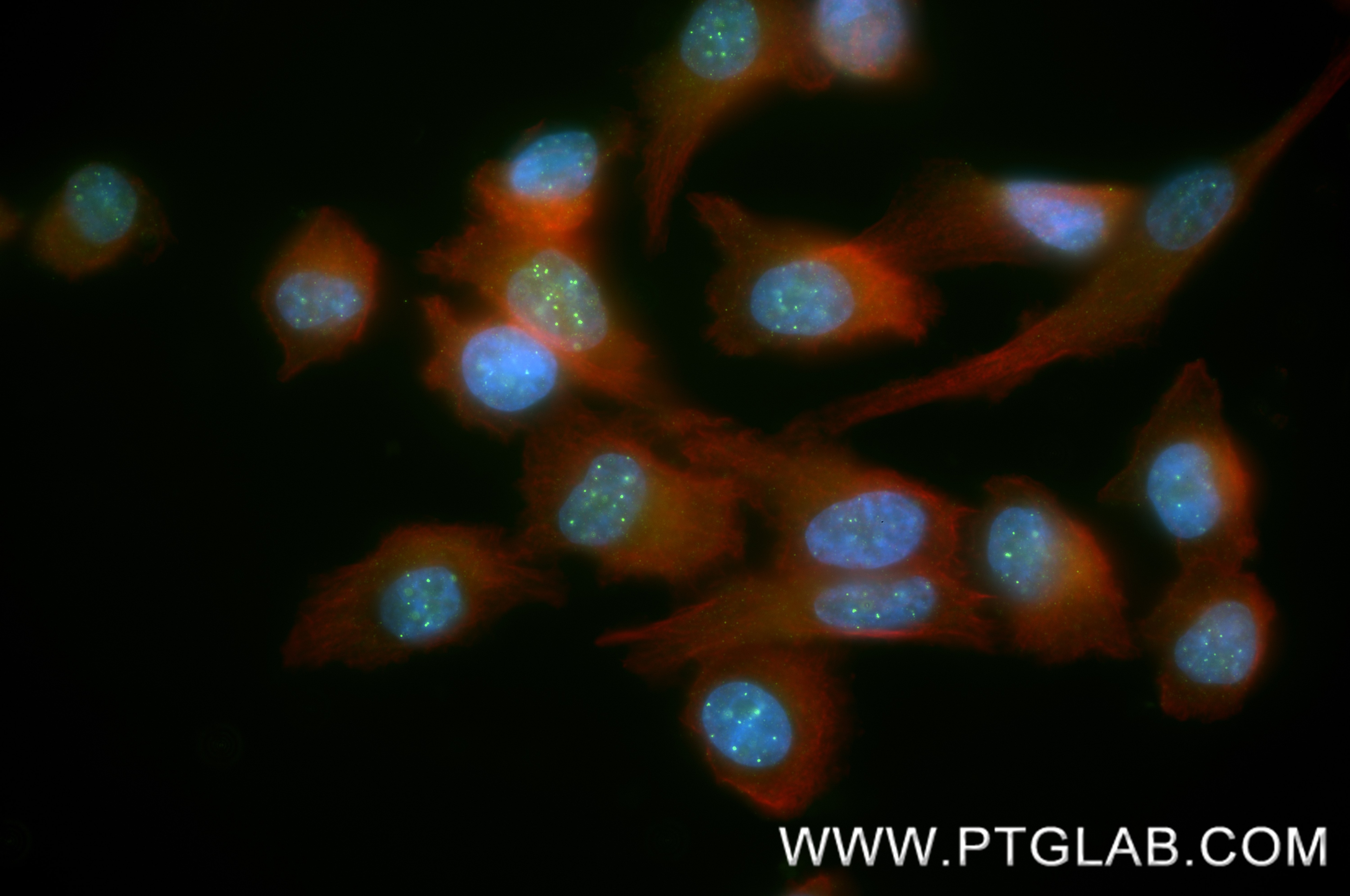 IF Staining of PC-3 using 88445-1-RR (same clone as 88445-1-PBS) Immunofluorescence (IF) / fluorescent staining of PC-3 cells using CENPA Recombinant monoclonal antibody (88445-1-RR)