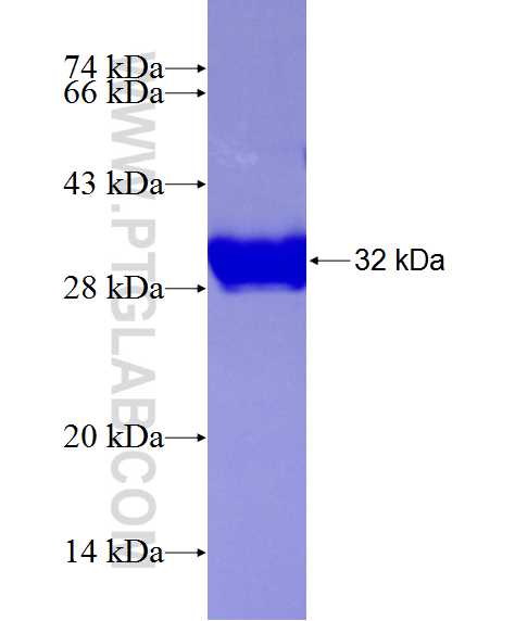 CENPA fusion protein Ag25025 SDS-PAGE