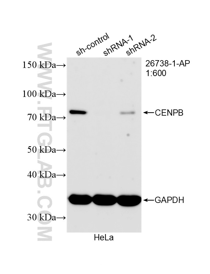 WB analysis of HeLa using 26738-1-AP (same clone as 26738-1-PBS) Western Blot (WB) analysis of HeLa cells using CENPB Polyclonal antibody (26738-1-AP)