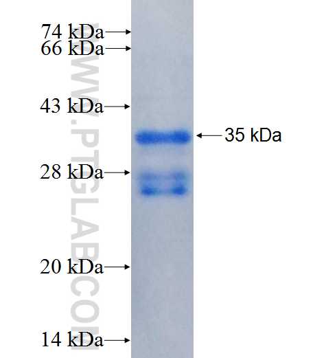 CENPB fusion protein Ag24967 SDS-PAGE