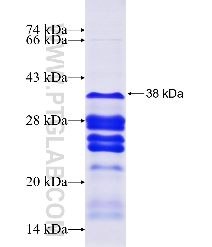 CENPB fusion protein Ag24967 SDS-PAGE