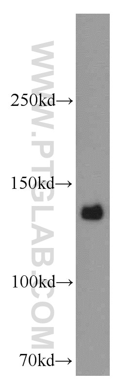 Western Blot (WB) analysis of HeLa cells using CENPC Polyclonal antibody (14250-1-AP)