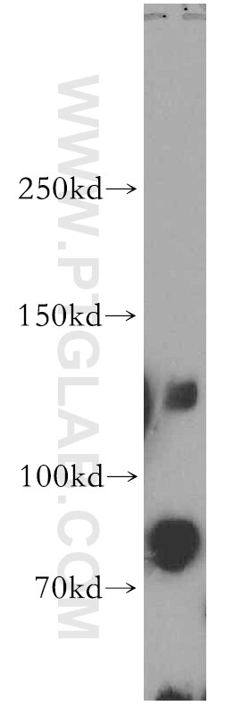 Western Blot (WB) analysis of A431 cells using CENPC Polyclonal antibody (14250-1-AP)