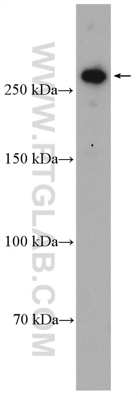 WB analysis of HeLa using 28142-1-AP