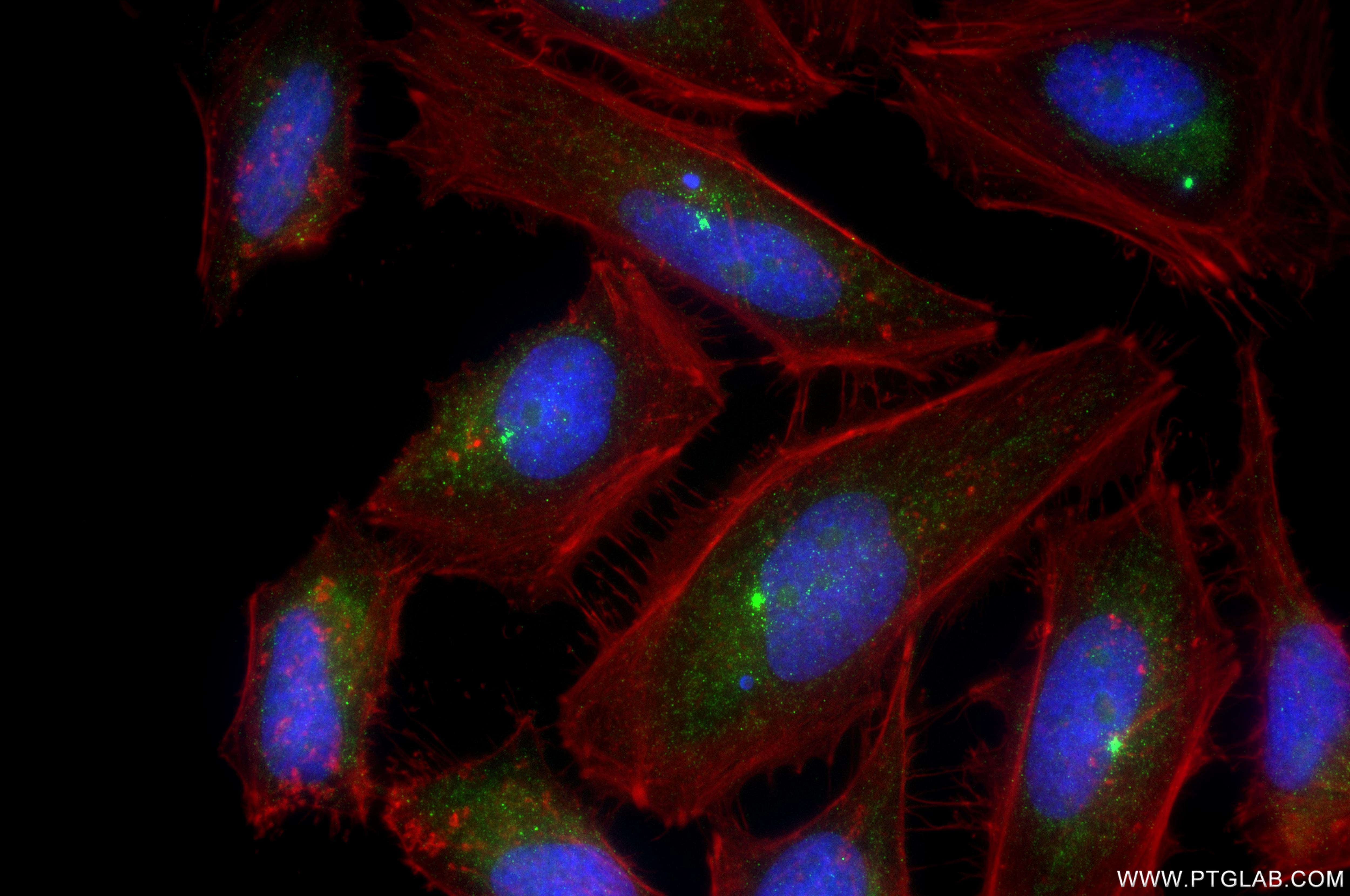 Immunofluorescence (IF) / fluorescent staining of HeLa cells using CENPE Recombinant monoclonal antibody (86805-3-RR)