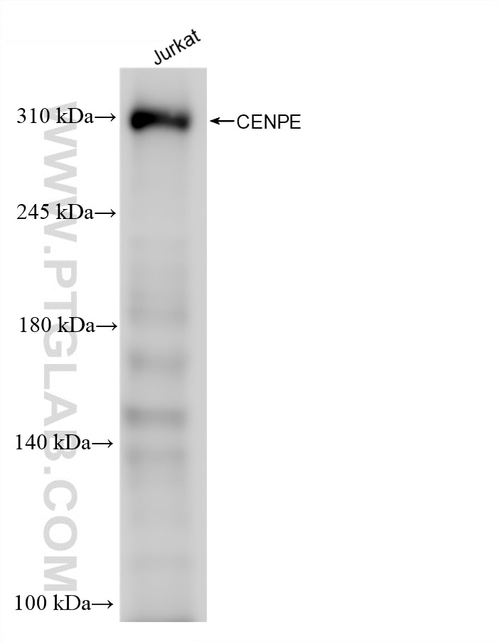 Western Blot (WB) analysis of various lysates using CENPE Recombinant monoclonal antibody (86805-3-RR)