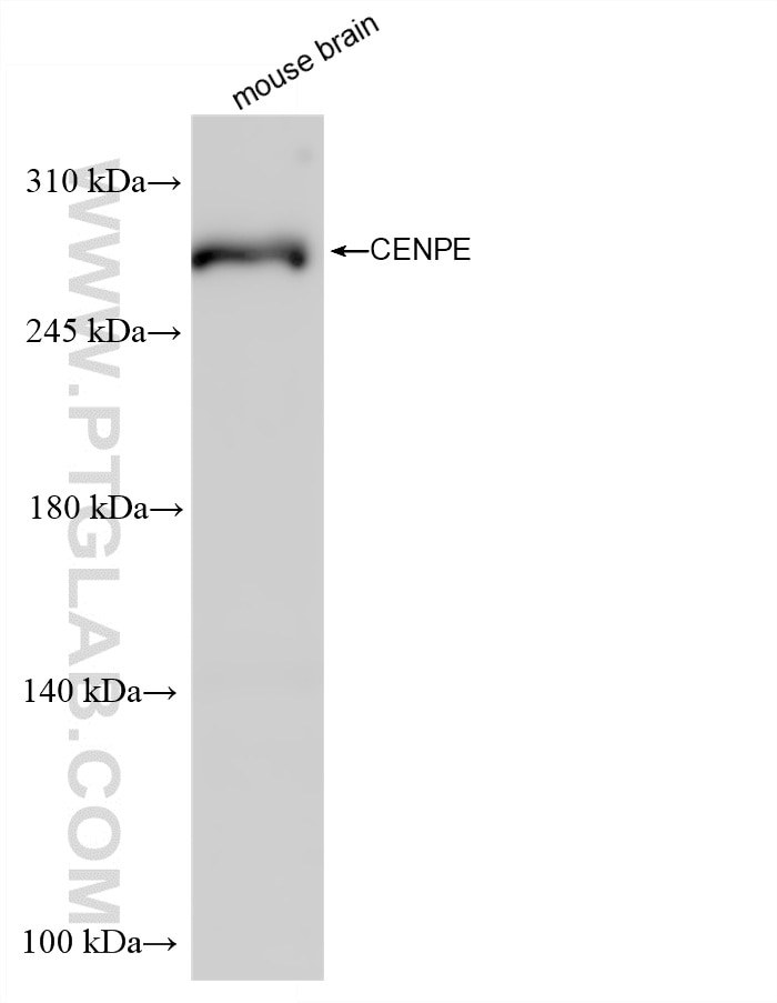 Western Blot (WB) analysis of various lysates using CENPE Recombinant monoclonal antibody (86805-3-RR)