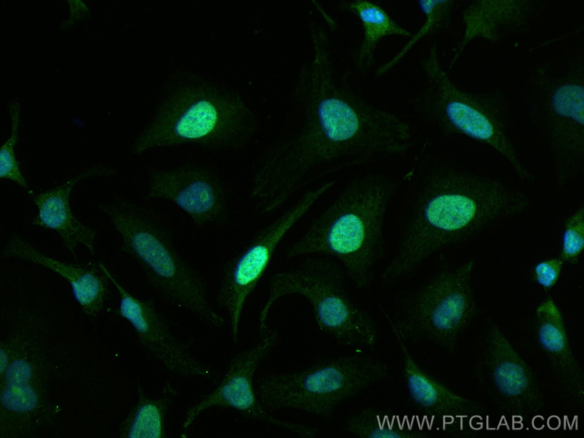 Immunofluorescence (IF) / fluorescent staining of HeLa cells using CENPF Polyclonal antibody (28568-1-AP)