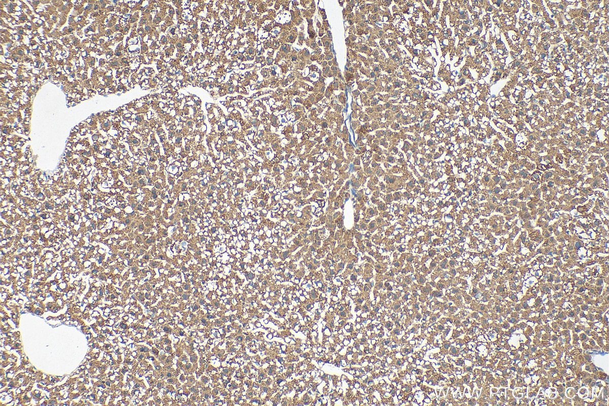 Immunohistochemistry (IHC) staining of mouse liver tissue using CENPF Polyclonal antibody (28568-1-AP)