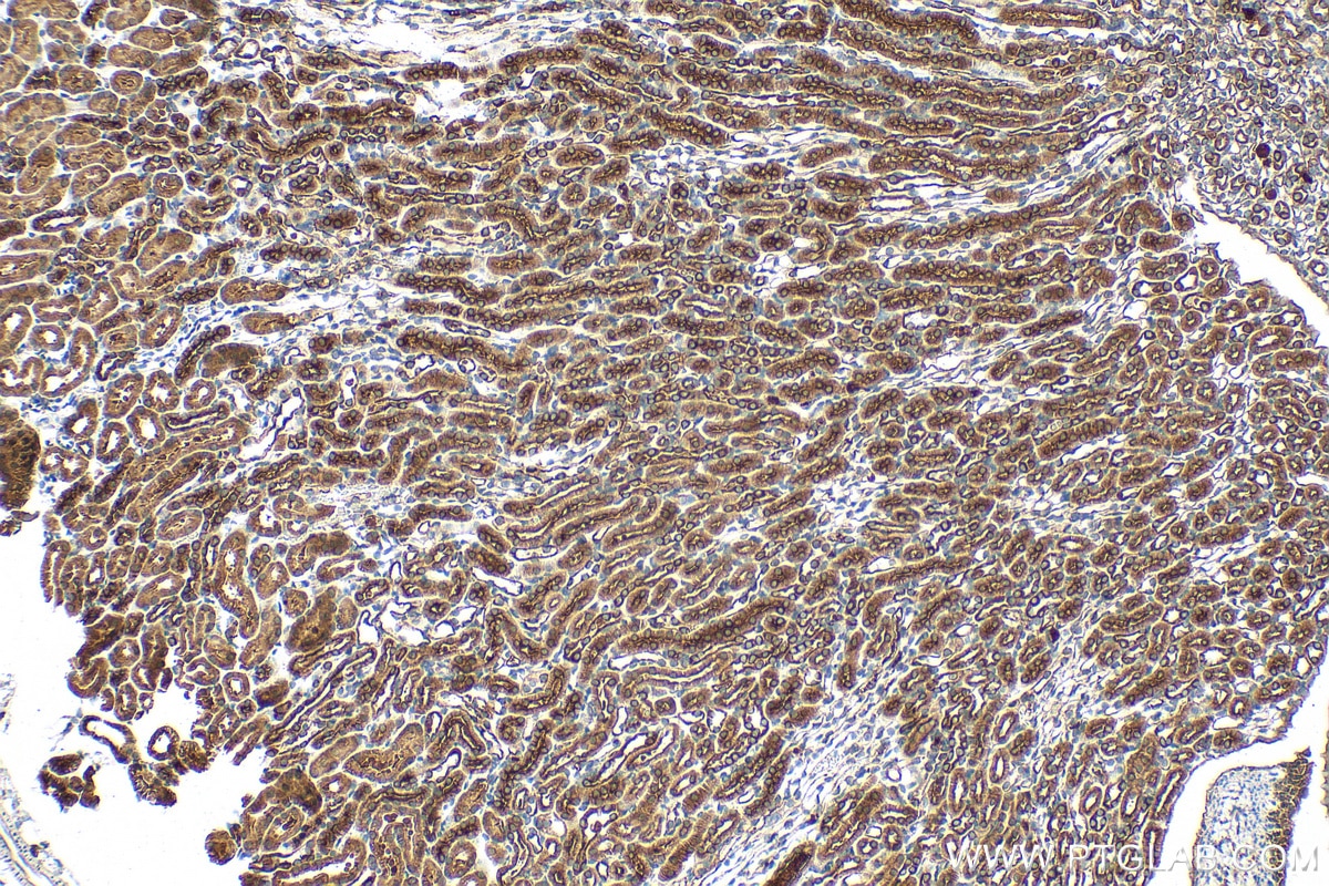 Immunohistochemistry (IHC) staining of mouse kidney tissue using CENPF Polyclonal antibody (28568-1-AP)
