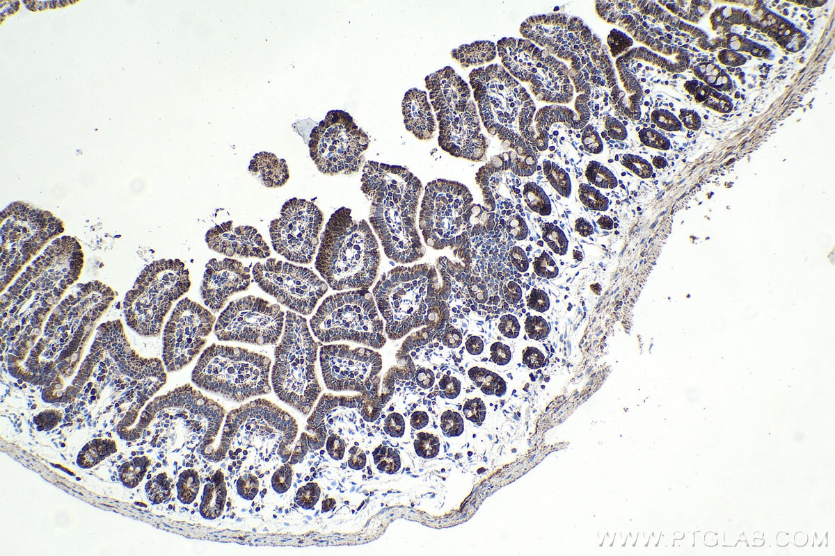 Immunohistochemistry (IHC) staining of mouse small intestine tissue using CENPF Polyclonal antibody (28568-1-AP)