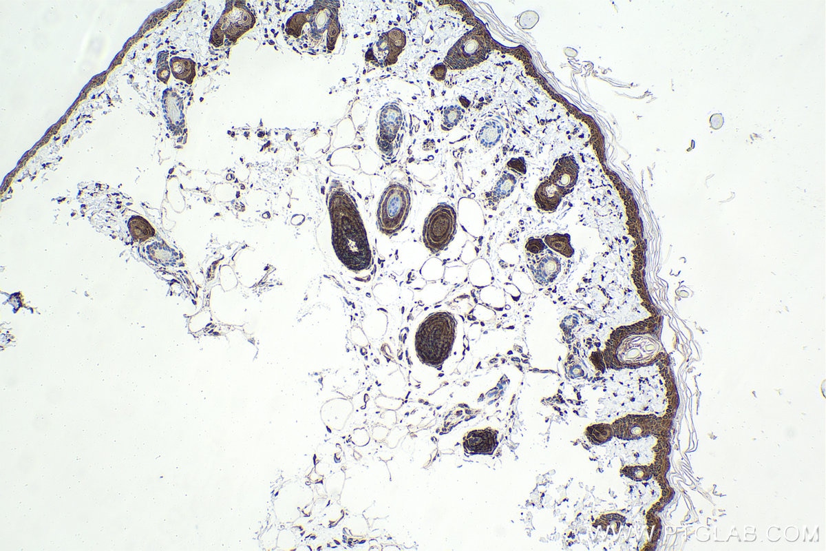 Immunohistochemistry (IHC) staining of rat skin tissue using CENPF Polyclonal antibody (28568-1-AP)
