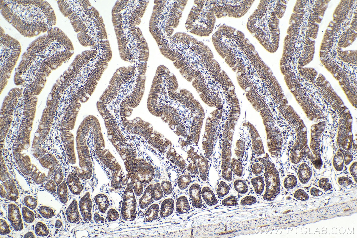 Immunohistochemistry (IHC) staining of rat small intestine tissue using CENPF Polyclonal antibody (28568-1-AP)