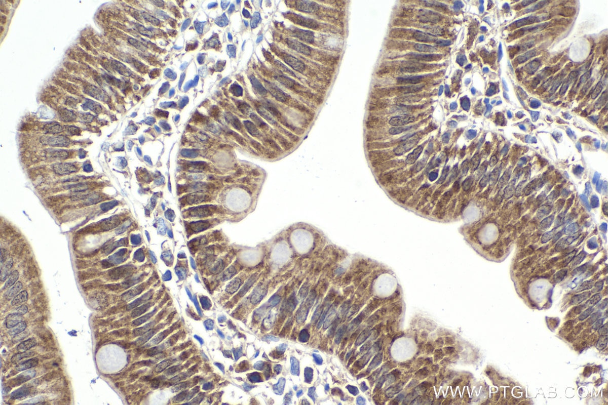 Immunohistochemistry (IHC) staining of rat small intestine tissue using CENPF Polyclonal antibody (28568-1-AP)