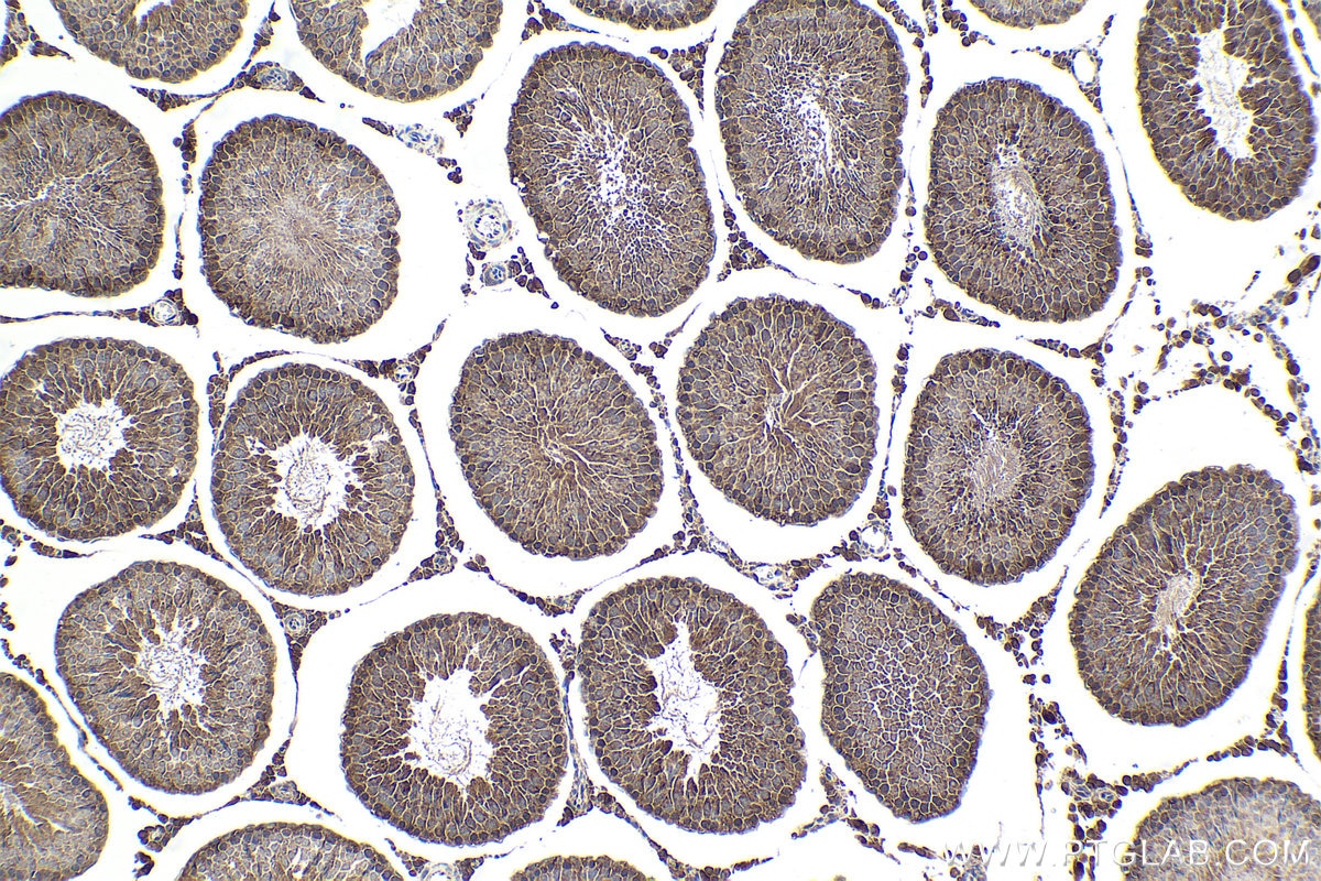 Immunohistochemistry (IHC) staining of rat testis tissue using CENPF Polyclonal antibody (28568-1-AP)