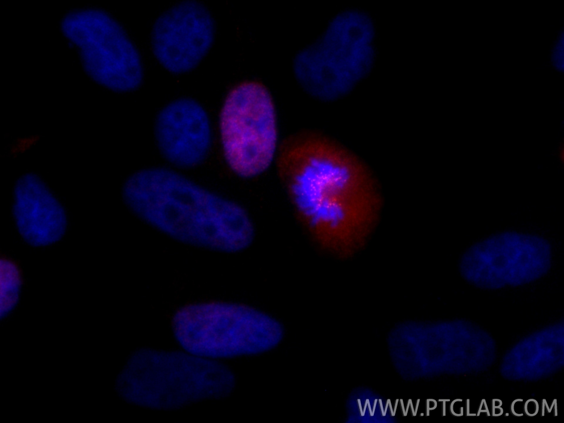 Immunofluorescence (IF) / fluorescent staining of HeLa cells using CoraLite®594-conjugated CENPF Recombinant antibody (CL594-84865-4)